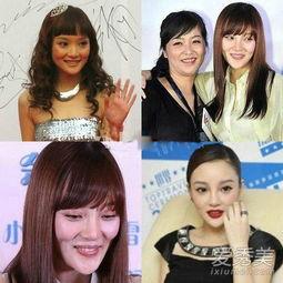 明星整容女孩失败了,美丽代价与反思